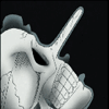 xray